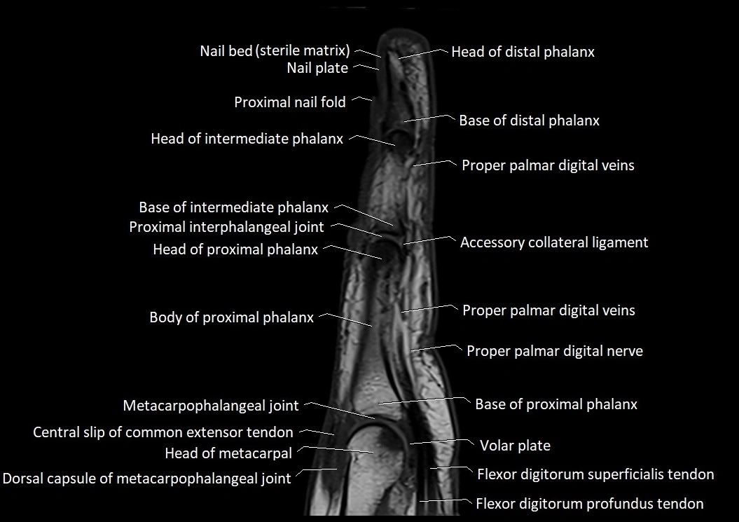 Finger anatomy sagittall cross section 3T image 7.webp